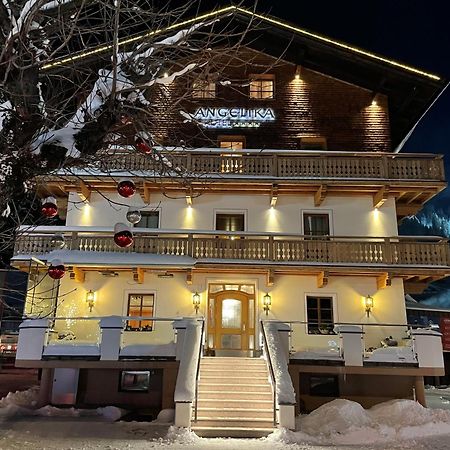 Hotel Angelika ซังคท์อันทอนอัมอาร์ลแบร์ก ภายนอก รูปภาพ